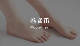 top_banner_wound_nail